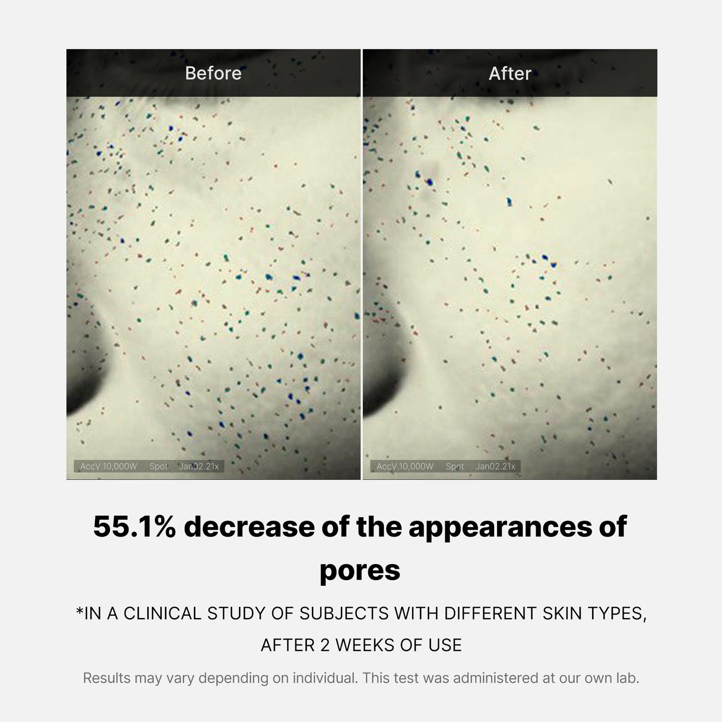 pore-care-duo-j7 05_12ddab8a-64be-4612-8ee1-27e5ec701921.jpg