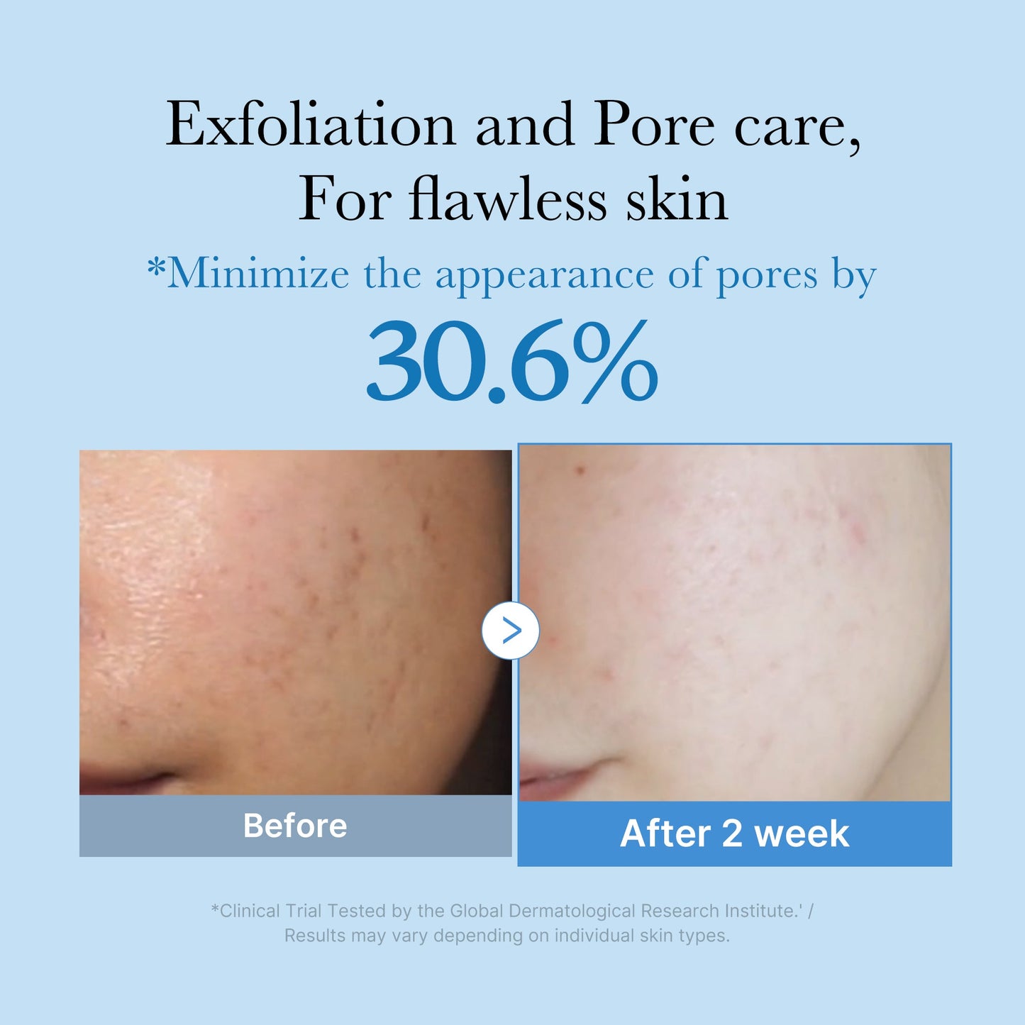 zero-pore-toner-a5 01_d6480b4e-3c08-4954-994a-ed5212c1839c.jpg