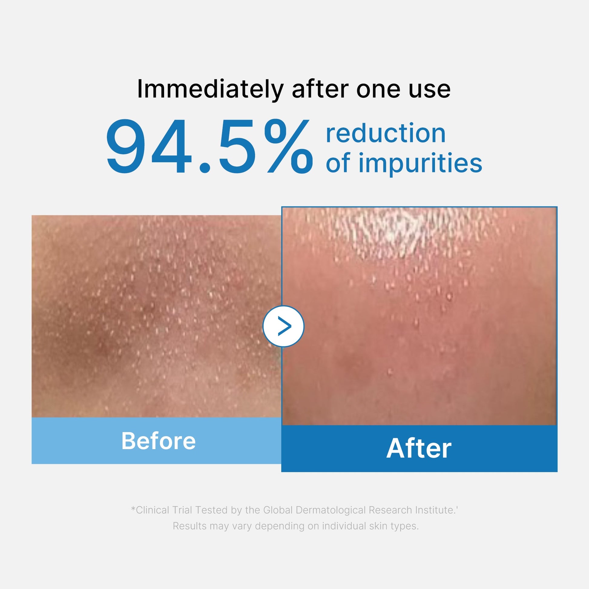 zero-pore-blackhead-deep-cleansing-oil-a7 01_eed557ec-5857-46a2-8b17-dbd67c692dcb.jpg
