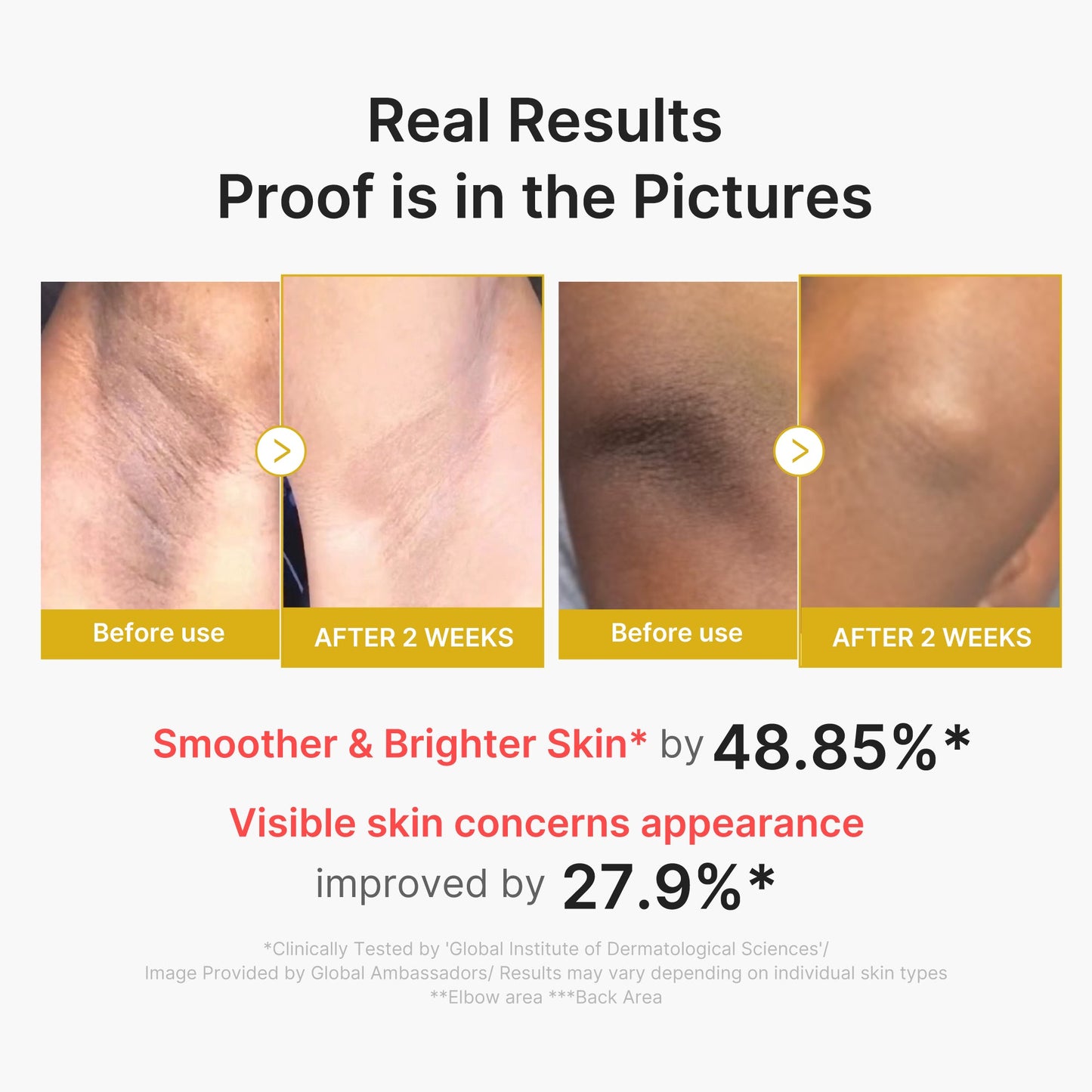 kojic-acid-turmeric-body-peel-shot-q8 02_72880cfc-382b-440b-8152-7e3dce87da2a.jpg