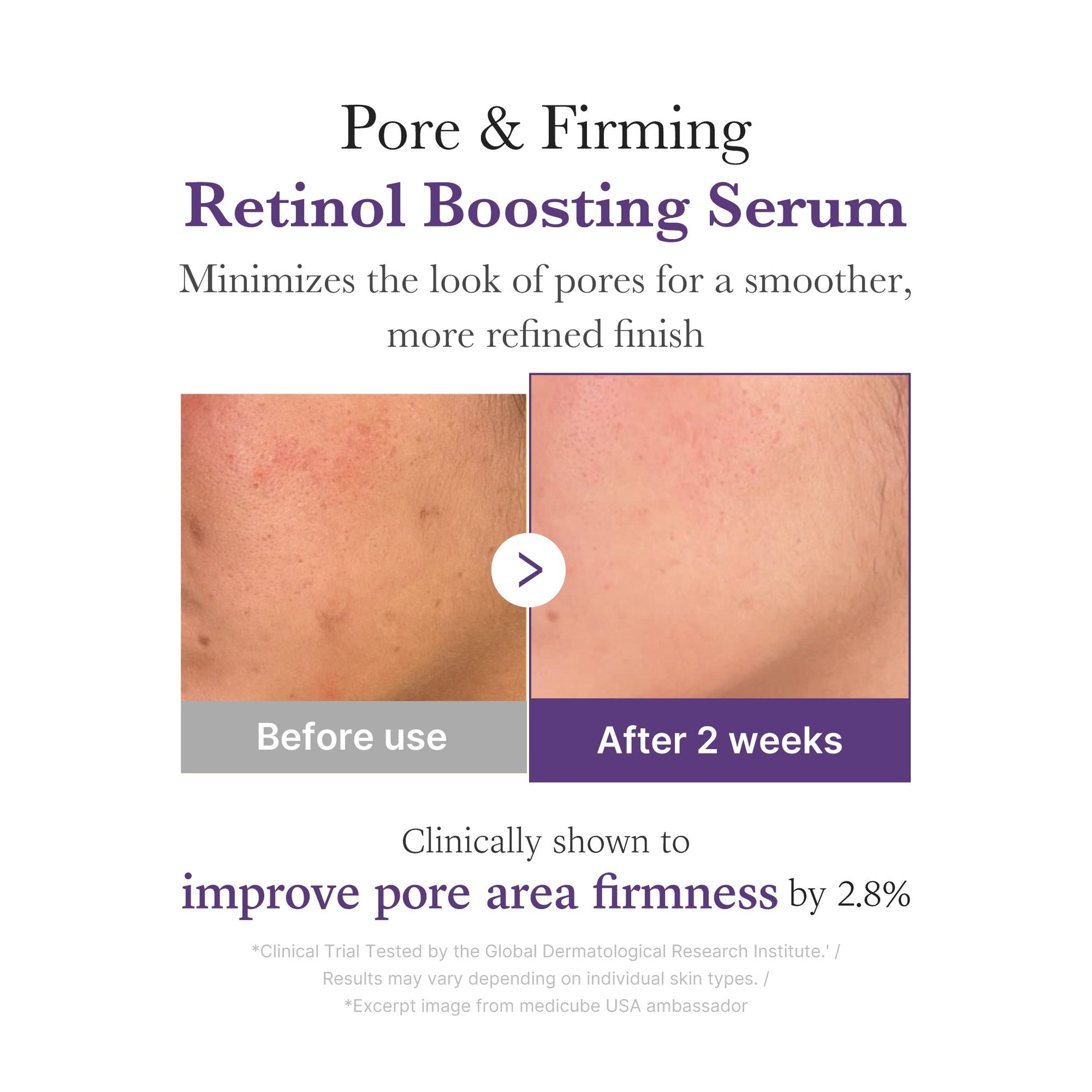 retinol-nmn-boosting-serum-r7 03_3510e7a5-5633-4a18-81ea-1389593bd517.jpg