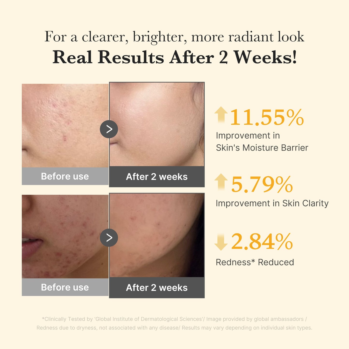 kojic-acid-turmeric-capsule-serum-z5 03_436487f5-76df-490e-8a61-01118373efbd.jpg