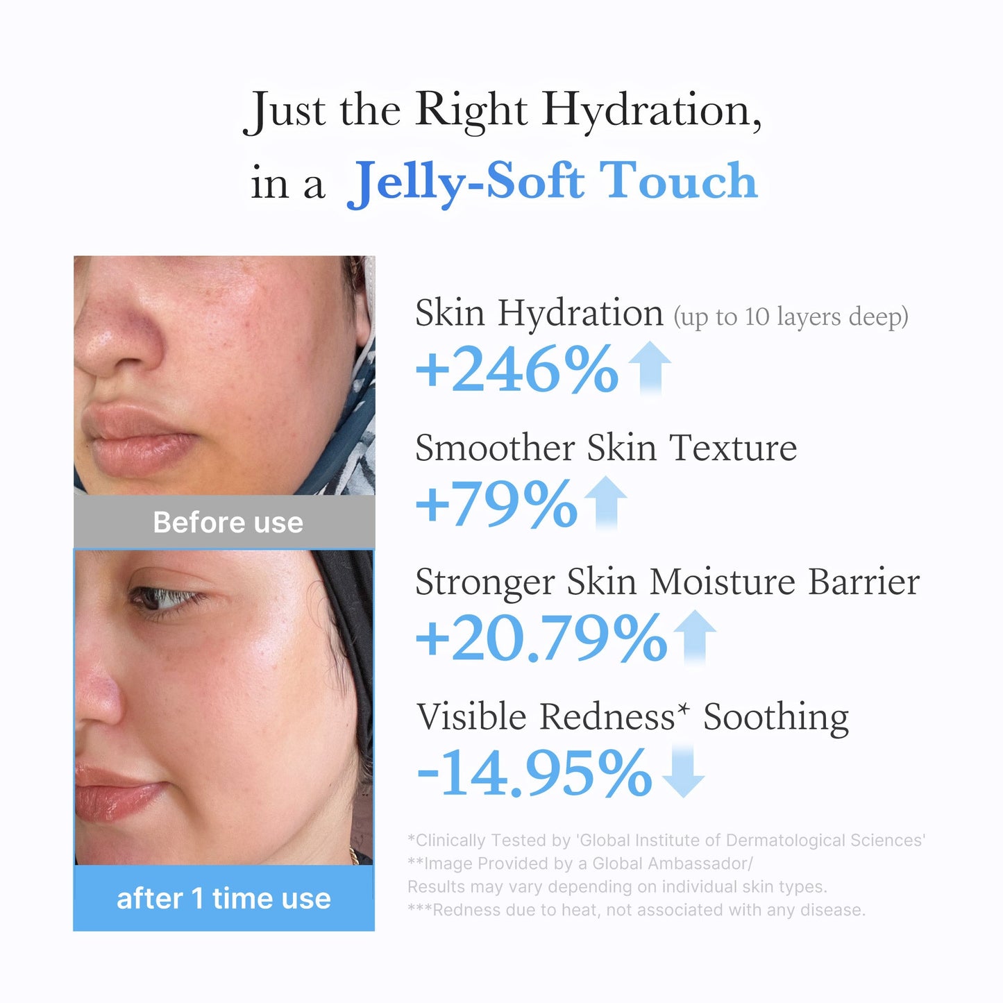 hyaluronic-ceramide-moisturizing-jelly-cream-x7 03_c39d66cc-0839-4e48-ab4a-d32143d06b1c.jpg