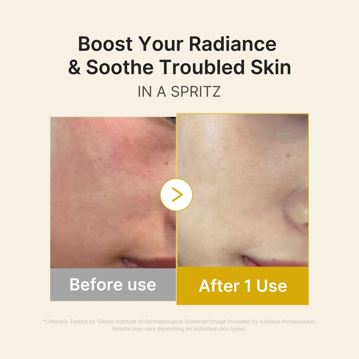 kojic-acid-turmeric-vitamin-gold-jelly-mist-serum-q4 03_dc9cd19e-4e57-49d3-9b66-c7762e8a63f1.jpg