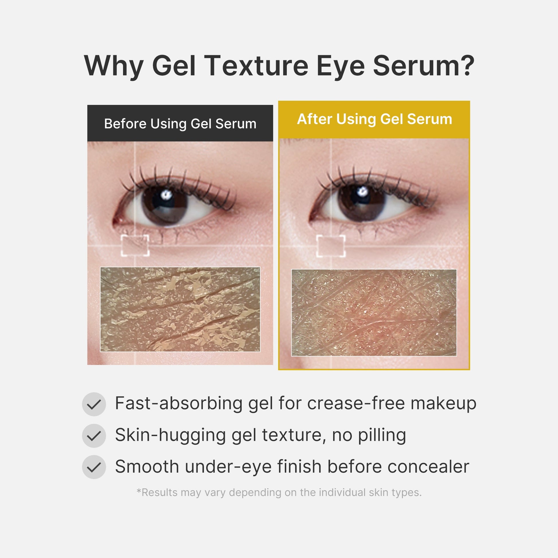 kojic-acid-tumeric-eye-gel-serum-t1 04_0487ef36-49f4-4294-8049-bb55118b05fe.jpg