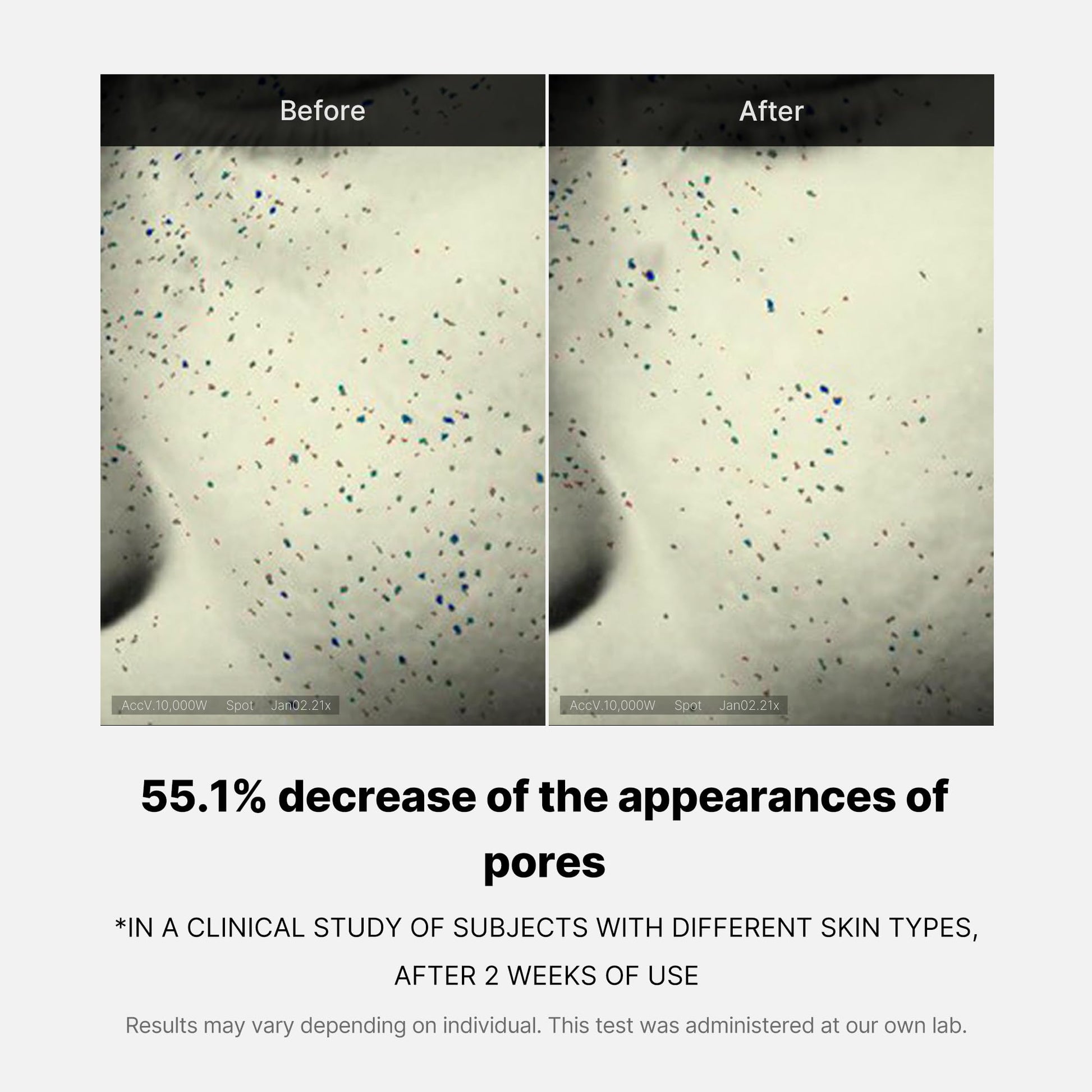 zero-pore-one-day-cream-v8 04_3616addc-f184-4deb-a5d7-e3a782e4713d.jpg