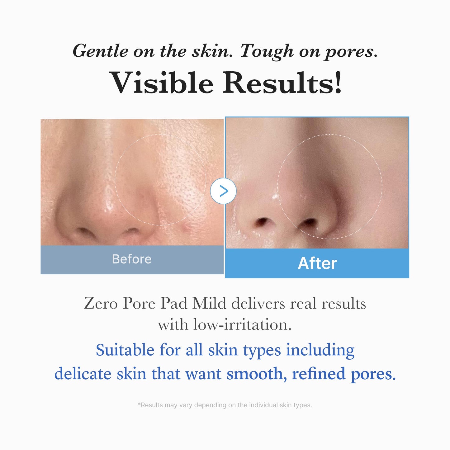 zero-pore-madecassoside-pads-mild-a9 04_6357f9f9-483b-4891-82c6-a58d336e62c8.jpg