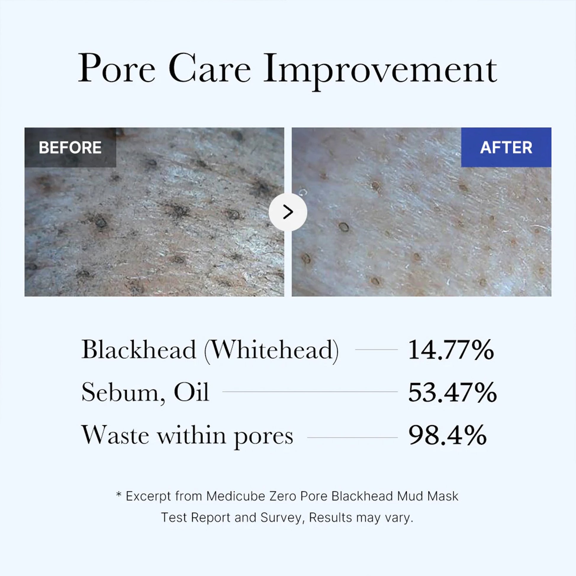 zero-pore-blackhead-mud-mask-h0 05_9362a158-c2b3-4525-acc0-631a2cfdea47.jpg
