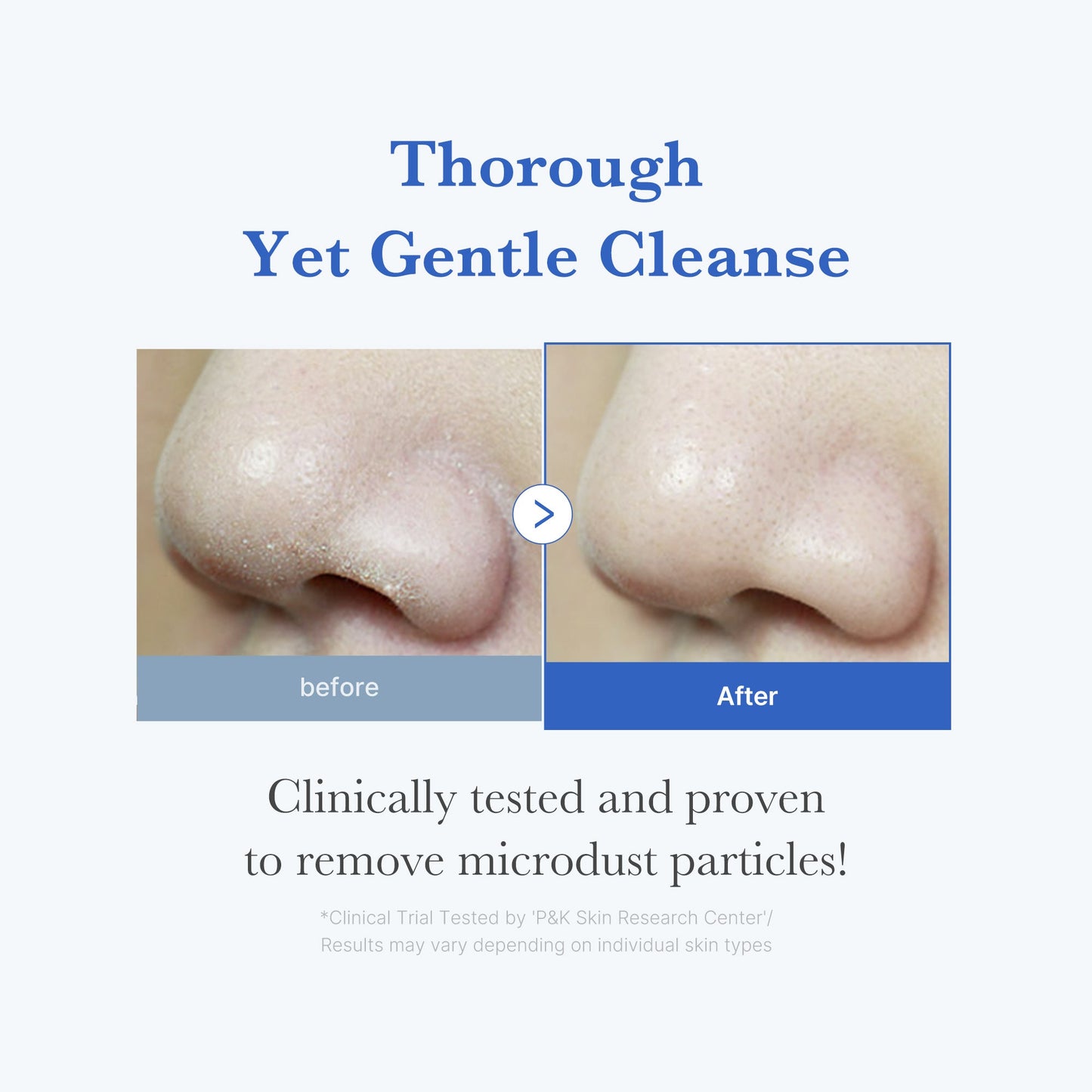 zero-foam-cleanser-b5 250702_ZeroCleanser3.jpg