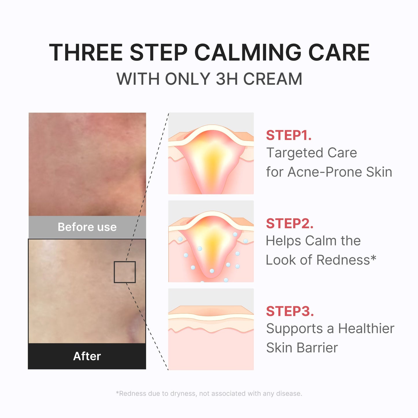 3h-daily-relief-cream-y5 3H_04.jpg