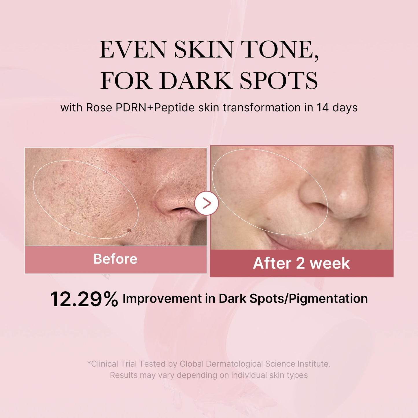pdrn-pink-peptide-toner-z0 PDRN_01_308c518e-5ac6-4e54-99bd-eabc8796739b.jpg