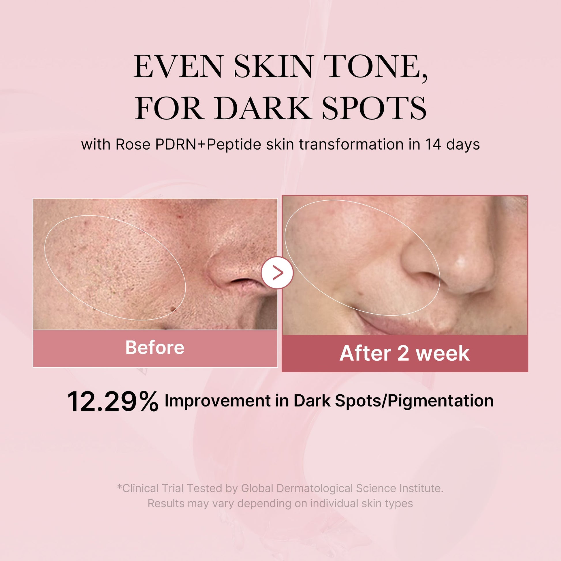 pdrn-pink-peptide-toner-z0 PDRN_01_308c518e-5ac6-4e54-99bd-eabc8796739b.jpg