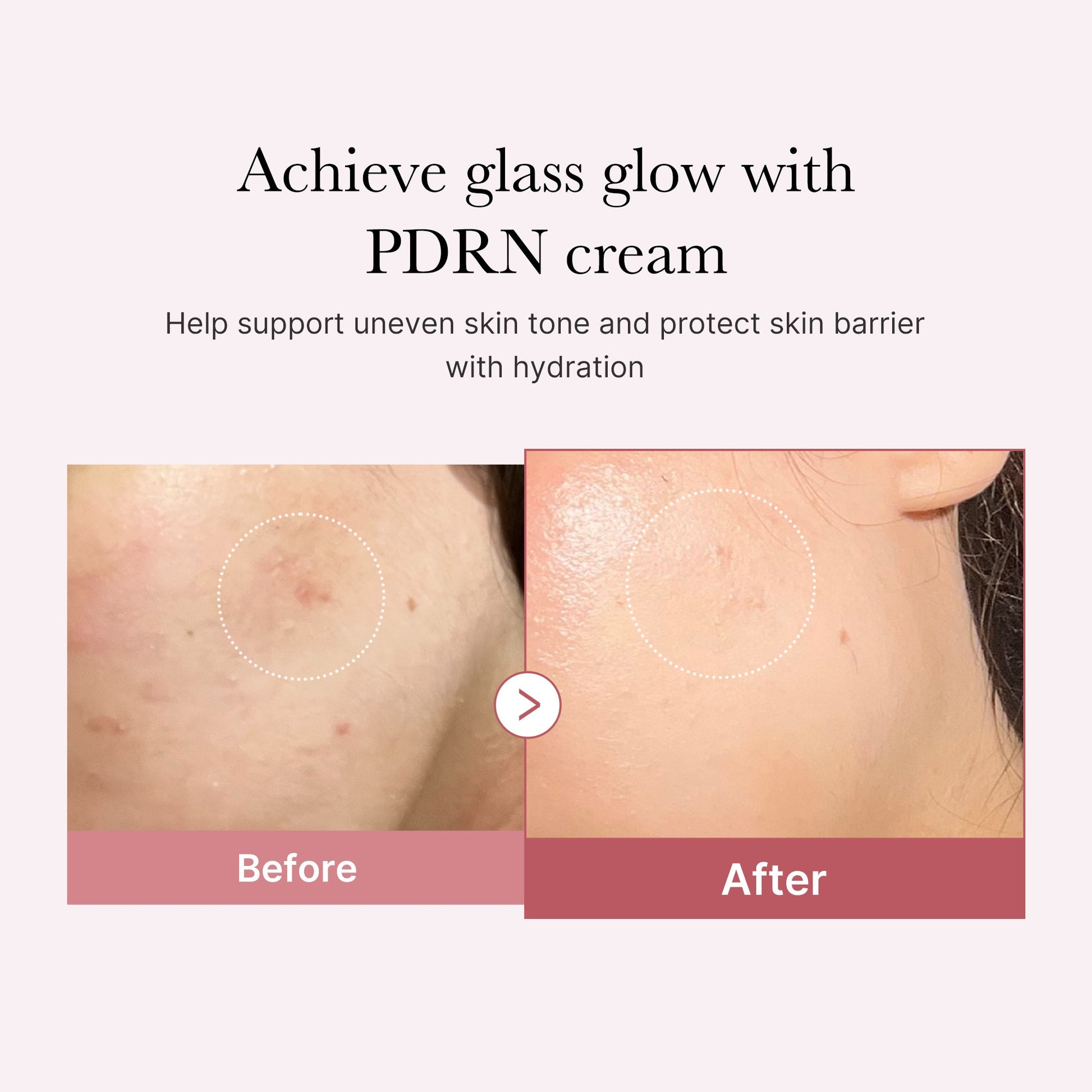 pdrn-pink-peptide-cream-g8 PDRN_02_d7805bfe-cf43-446a-b71b-a276683f136b.jpg