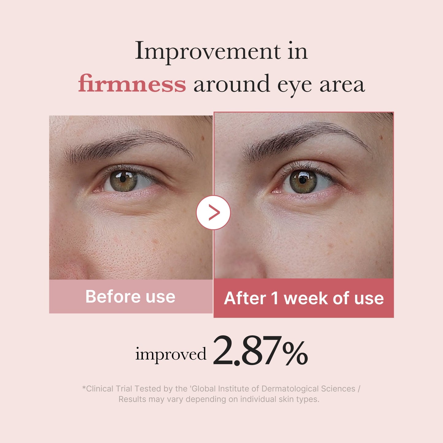pdrn-pink-peptide-eye-cream-i8 PDRN_03_256dd753-0a2f-41b4-b3cd-bbfd3bc27018.jpg
