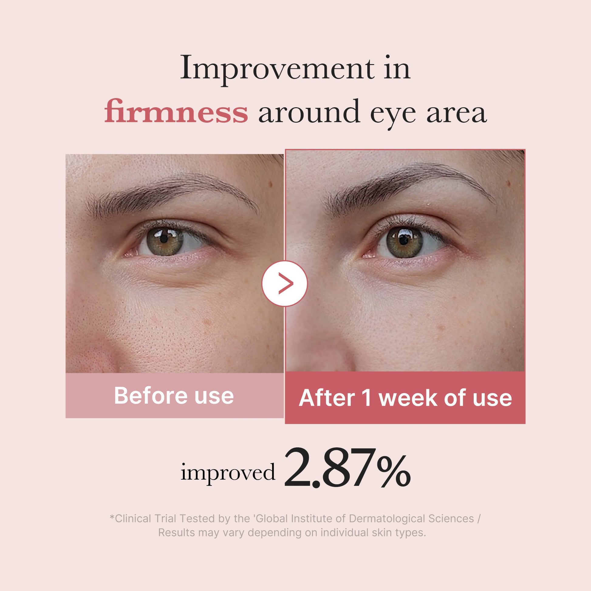 pdrn-pink-peptide-eye-cream-i8 PDRN_03_256dd753-0a2f-41b4-b3cd-bbfd3bc27018.jpg