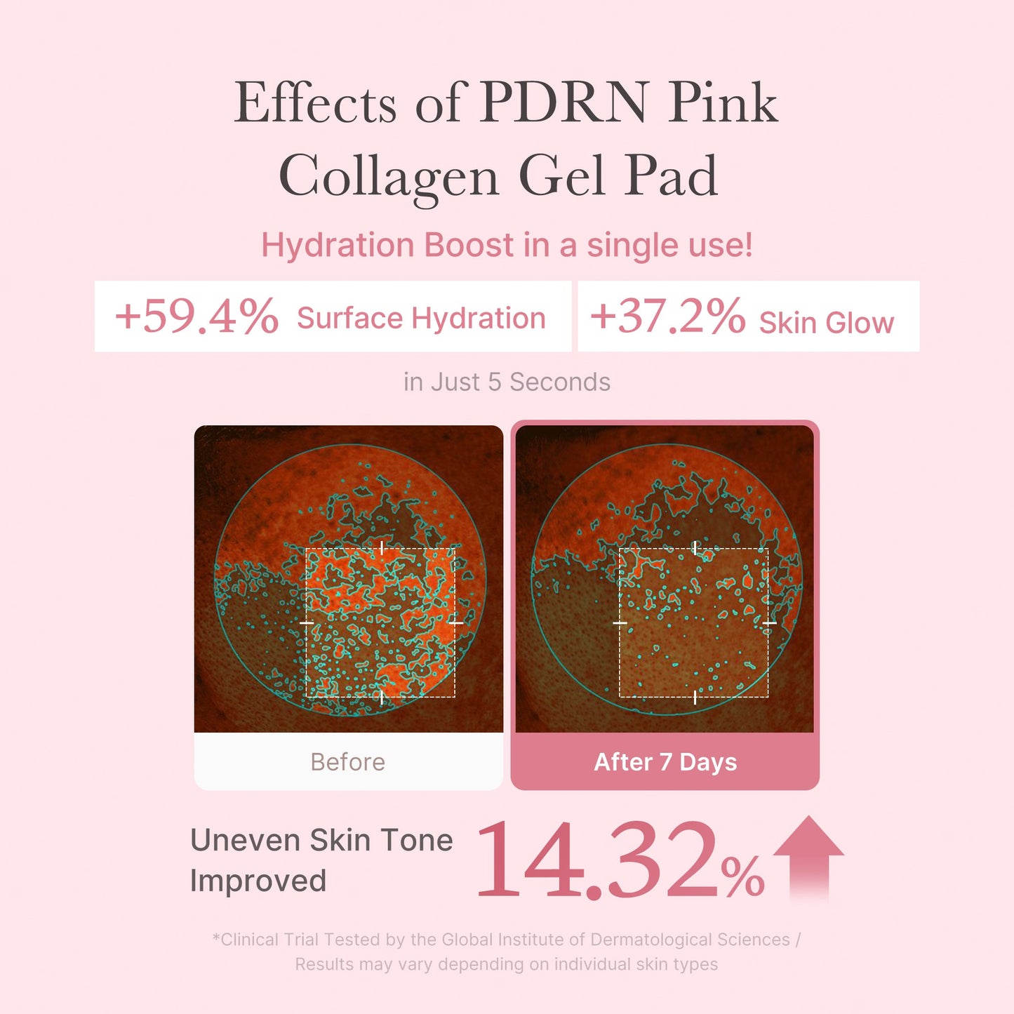 pdrn-pink-collagen-gel-toner-pad-q0 PDRN_04_f9a16a56-8d9e-4c47-a635-ed34ec3ed571.jpg