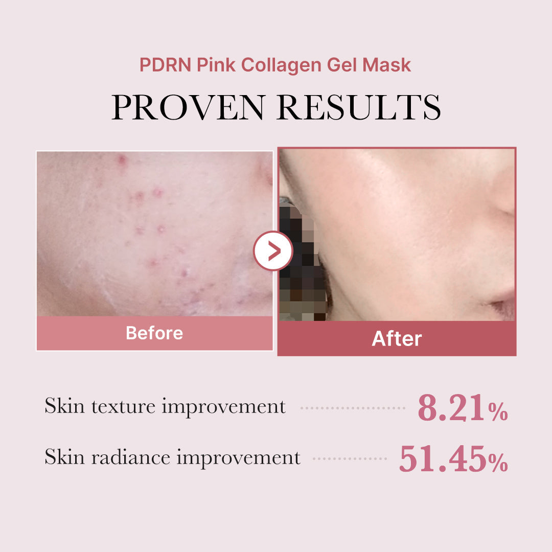 salmon-pdrn-pink-collagen-jelly-gel-mask-w4 PDRN_12.jpg