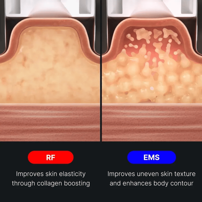 age-r-contour-body-shot-m2 img.webp